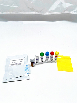 99,9% certification de Kitwith FSC d'extraction d'ADN d'ARN de Kit Viral de réactif d'ACP de pureté