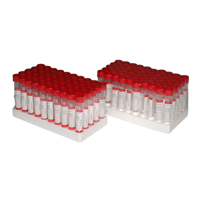 écouvillon jetable médical de 5ml VTM Kit Sample Storage Tube With